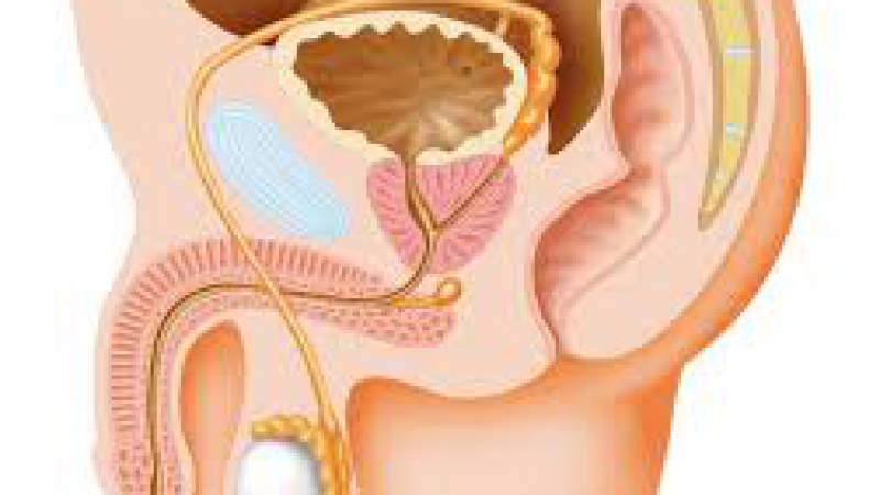  Bi prepoznali raka prostate?